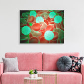 Sichelzellanämie mit roten Blutkörperchen Leinwanddruck (Insitu (Wohnzimmer))