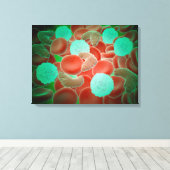 Sichelzellanämie mit roten Blutkörperchen Leinwanddruck (Insitu (Holzboden))