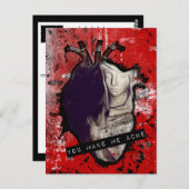 Sie lassen mich anatomisches Herz schmerzen Postkarte (Vorne/Hinten)