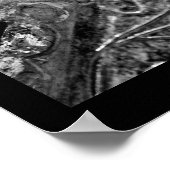 Silberleaf Poster (Ecke)