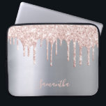 Silberrosa Glitzer Tropfen Metallname gürtlich Laptopschutzhülle<br><div class="desc">Ein elegantes,  mädchenhaftes und glamouröses Pad-Gehäuse. Imitate Rose Gold und rosa Glitzer Tropfen,  malen Tropfen. Chic Imitate silber metallisch aussehend Hintergrund. Geben Sie Ihren Namen ein,  der mit einem modernen handgeschriebenen Stilskript geschrieben wurde. Rose Gold,  rosa Buchstaben.</div>