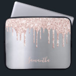 Silberrosa Glitzer Tropfen Metallname gürtlich Laptopschutzhülle<br><div class="desc">Ein elegantes,  mädchenhaftes und glamouröses Pad-Gehäuse. Imitate Rose Gold und rosa Glitzer Tropfen,  malen Tropfen. Chic Imitate silber metallisch aussehend Hintergrund. Geben Sie Ihren Namen ein,  der mit einem modernen handgeschriebenen Stilskript geschrieben wurde. Rose Gold,  rosa Buchstaben.</div>