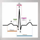 Sinusrhythmus in einem EKG-EKG-Diagramm Poster (Vorne)