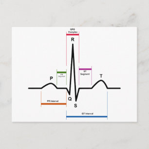 Sinusrhythmus in einem EKG-EKG-Diagramm Postkarte