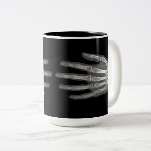 Skeleton Hand X-Ray Zweifarbige Tasse (VorderseiteRechts)