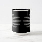 Skeleton Hand X-Ray Zweifarbige Tasse (Mittel)