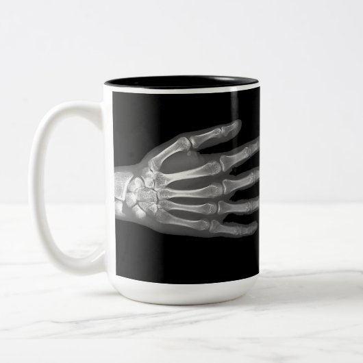 Skeleton Hand X-Ray Zweifarbige Tasse (Links)