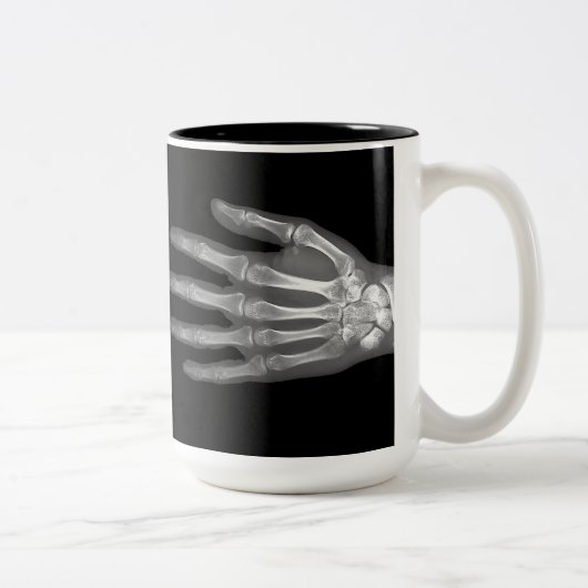 Skeleton Hand X-Ray Zweifarbige Tasse (Rechts)