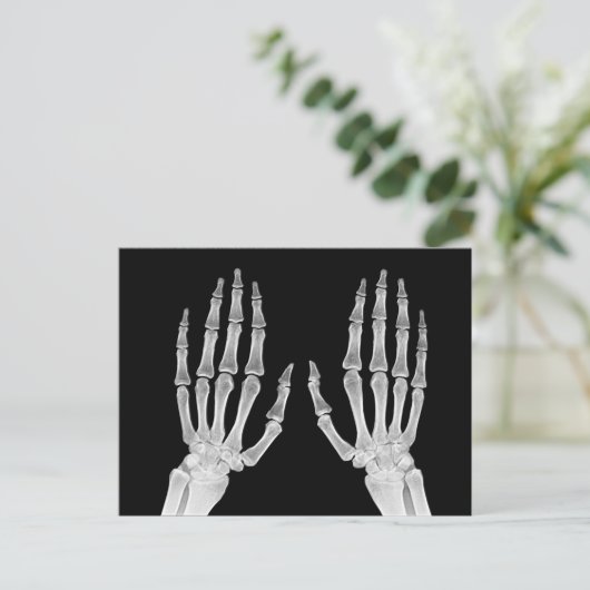 Skeleton Hands Xray Picture Human Anatomy Foto Postkarte (Stehend Vorderseite)