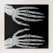 Skeleton Hands Xray Picture Human Anatomy Foto Puzzle (Horizontal)