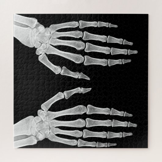Skeleton Hands Xray Picture Human Anatomy Foto Puzzle (Horizontal)