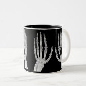 Skeleton Hands Xray Picture Human Anatomy photo Zweifarbige Tasse (VorderseiteRechts)