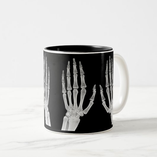 Skeleton Hands Xray Picture Human Anatomy photo Zweifarbige Tasse (VorderseiteRechts)