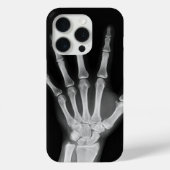 Skeleton iPhone 15 pro Cover (Rückseite)