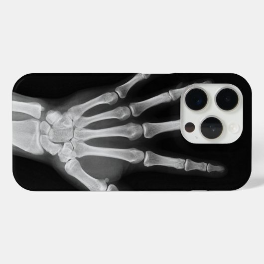 Skeleton iPhone 15 pro Cover (Rückseite (Horizontal))