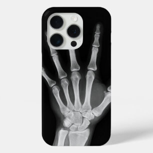 Skeleton iPhone 15 Pro-Hülle Case-Mate iPhone Hülle