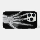 Skeleton iPhone 15 Pro-Hülle Hülle (Rückseite (Horizontal))
