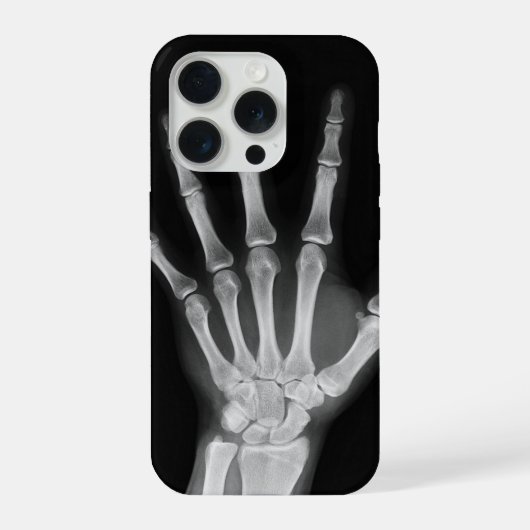 Skeleton iPhone 15 Pro-Hülle Hülle (Rückseite)