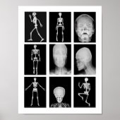 Skelett Skull Human Body XRAYS Collage Art Poster (Vorne)