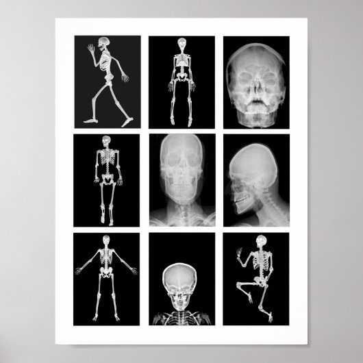 Skelett Skull Human Body XRAYS Collage Art Poster (Vorne)