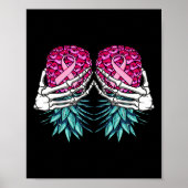 Skeletthandschuh auf dem Kopf Ananas Poster (Vorne)