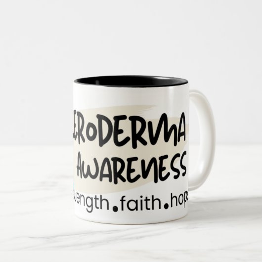 Skleroderma Magnete Zweifarbige Tasse (VorderseiteRechts)