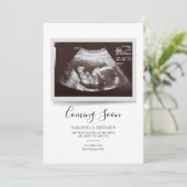 Skript-Sonogramm kommt bald Schwangerschaft Ankünd (Stehend Vorderseite)