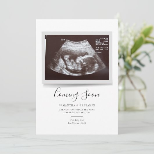 Skript-Sonogramm kommt bald Schwangerschaft Ankünd (Stehend Vorderseite)