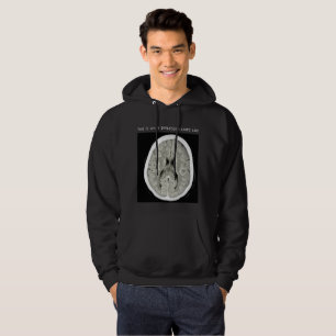 So sieht Depression aus wie FullCTScan Hoodie