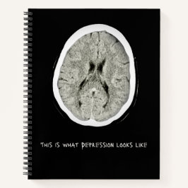So sieht Depressionen aus.CTFOD Notizblock