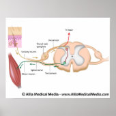 Somatischer Reflex, beschriftet. Poster (Vorne)