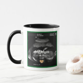Sonogram Baby Comon Bald Ankündigung für Opa Tasse