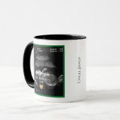 Sonogram Baby kommt bald Ankündigung für Onkel Tasse (Vorderseite Links)