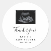 Sonogram Baby Shower Stickers (Vorderseite)