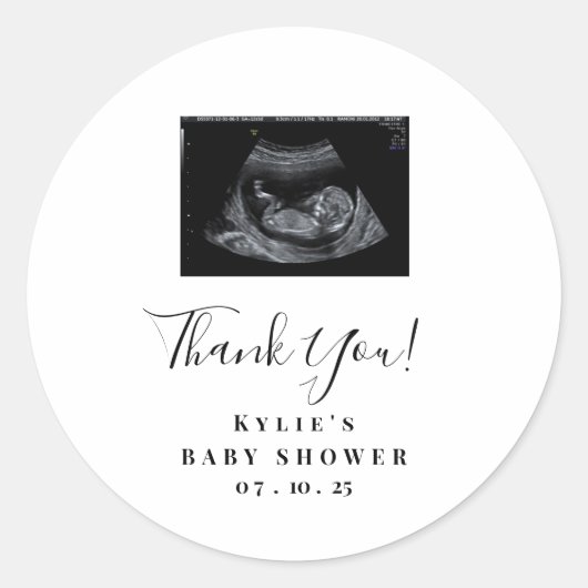 Sonogram Baby Shower Stickers (Vorderseite)