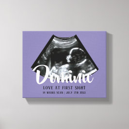 Sonogram Keepake Baby Ultrasound Canvas Print Leinwanddruck