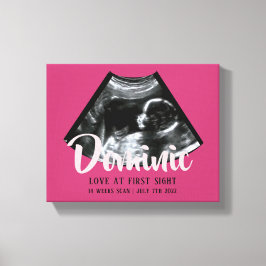 Sonogram Keepake Baby Ultrasound Canvas Print Leinwanddruck