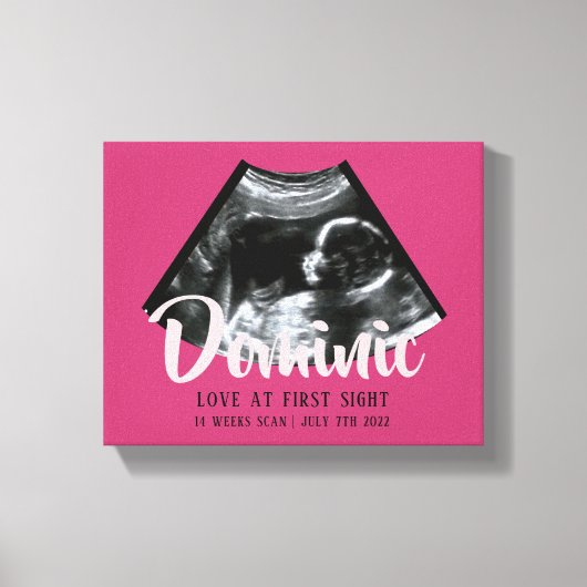 Sonogram Keepake Baby Ultrasound Canvas Print Leinwanddruck (Vorderseite)