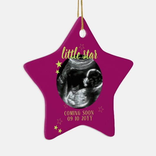 Sonogram Keepake Baby Ultrasound Keramik Ornament (Rechts)