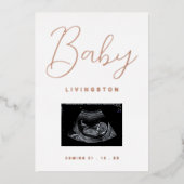 Sonogram Rose Gold Foil Pregnancy Ankündigung (Vorderseite)