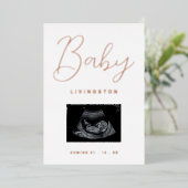 Sonogram Rose Gold Foil Pregnancy Ankündigung (Stehend vorne)