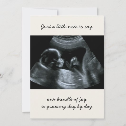 Sonogramm-Foto-Neutralcreme Ankündigung (Vorderseite)