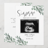 Sonogramm Neutral Grüne Karte Baby Ankündigung (Vorne/Hinten)