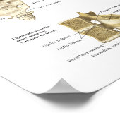 Spanische Anatomie Espinalspinalanatomie Diagramm Poster (Ecke)