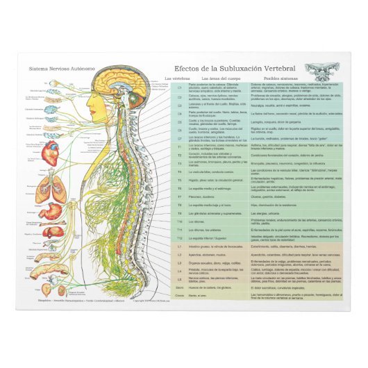 Spanische ANS Subluxation Effects reißen Pad Notizblock (Vorderseite)