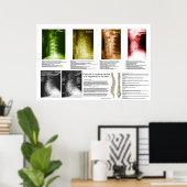 Spanische Phasen Zervikalspinale Entkernung Poster (Heimbüro)