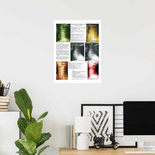 Spanischer Unterluxation Zervikalspinale Entkernun Poster (Heimbüro)