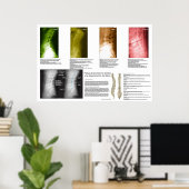 Spanisches Phases Lumbar Spinal Degenerations Post Poster (Heimbüro)