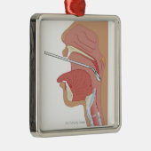 SpiegelLaryngoscopy Silbernes Ornament (Rechts)