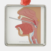 SpiegelLaryngoscopy Silbernes Ornament (Vorne)
